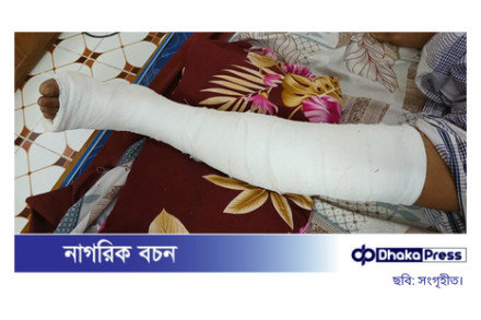 সালথায় চাঁদার টাকা না দেওয়ায় সাবেক পুলিশ সদস্যকে কুপিয়ে জখম