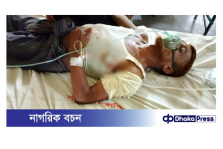 কুড়িগ্রামে আঃলীগ নেতাকে প্রকাশ্যে কোপালো যুবদল কর্মীরা