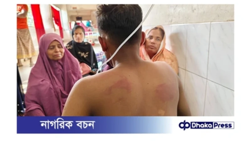 কুষ্টিয়ায় চুরির অভিযোগে দুই কিশোরকে রাতভর নির্যাতন, সকালে জরিমানা আদায়