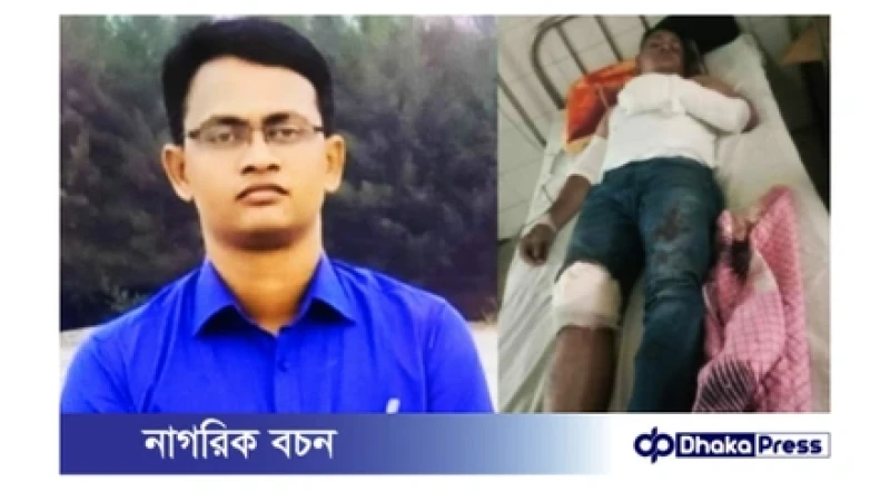 সড়কে গাছ ফেলে ডাকাতি: খবর পেয়ে অভিযানে গিয়ে দুর্বৃত্তদের হামলায় আহত পুলিশ কর্মকর্তা